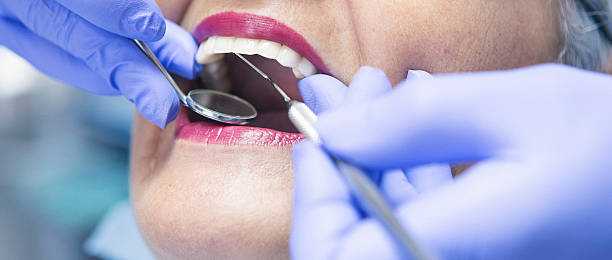 Best Emergency Dental Care for Trauma or Injury in Bnchard, LA